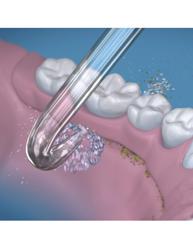 Hilo Dental Inalámbrico Waterpik ION con Puntas para Dentaduras