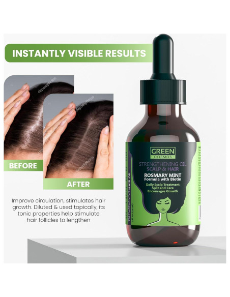 Aceite de Romero 100% Puro ShenZhen 60ml - Crecimiento Cabello