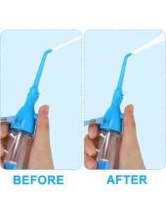 Irrigador Oral Manual Patelai 75ml Portátil Azul 2