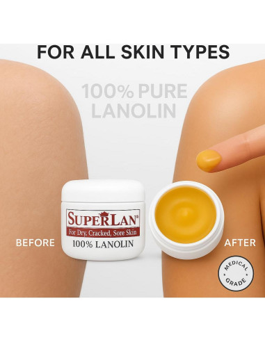 Crema Hidratante de Lanolina Superlan 28.35 g - 100% Natural