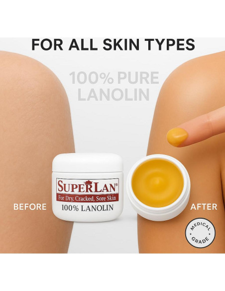 Crema Hidratante de Lanolina Superlan 28.35 g - 100% Natural