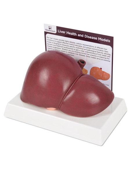 Modelo de Anatomía del Hígado Humano en Silicona 25.9x17 cm