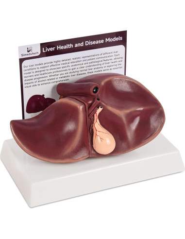 Modelo de Anatomía del Hígado Humano en Silicona 25.9x17 cm