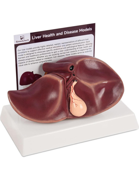 Modelo de Anatomía del Hígado Humano en Silicona 25.9x17 cm