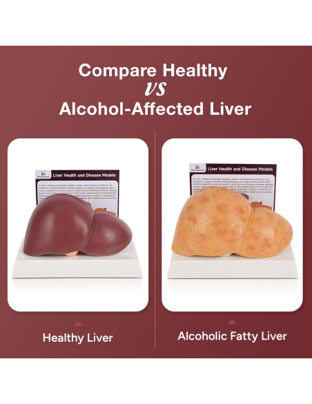 Modelo de Anatomía del Hígado Humano en Silicona 25.9x17 cm
