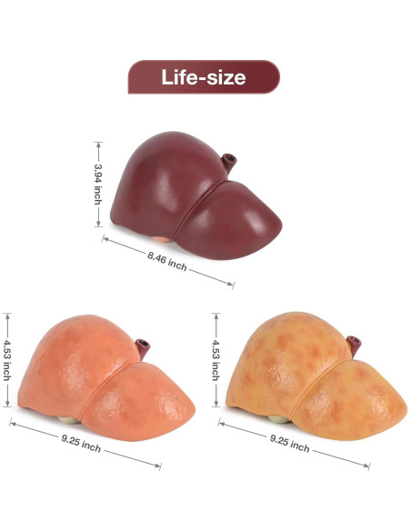 Modelo de Anatomía del Hígado Humano en Silicona 25.9x17 cm