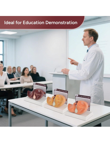 Modelo de Anatomía del Hígado Humano en Silicona 25.9x17 cm