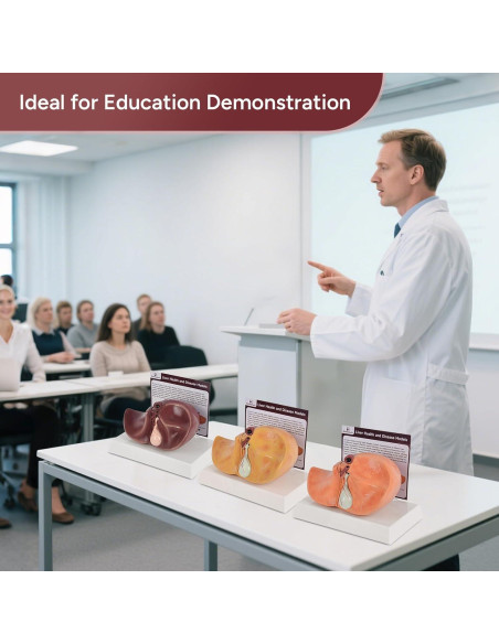 Modelo de Anatomía del Hígado Humano en Silicona 25.9x17 cm