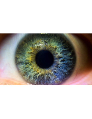 Lente Macro 10x Alta Definición para Leica Q Tipo 116 49mm