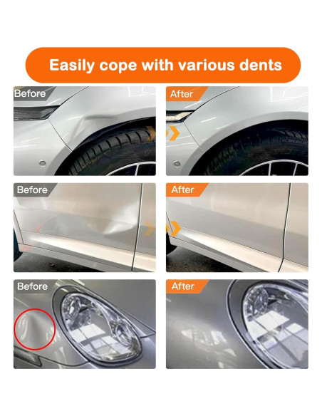 Extractor de Abolladuras JinRui-T XP-01, Paquete de 3 Unidades Extractor de Abolladuras JinRui-T XP-01, Paquete de 3 Unidades