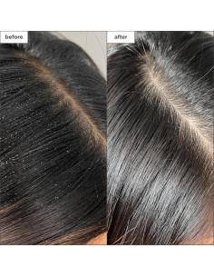 Spray Detox Briogeo 118 ml - Tratamiento Cuero Cabelludo Seco 2