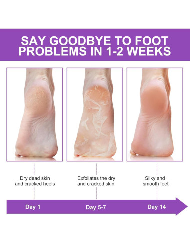 Mascarilla Exfoliante para Pies Wlytech - 5 Paquetes Hidratantes