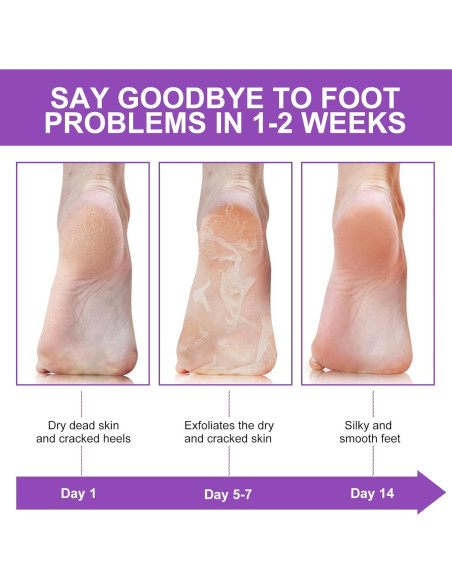 Mascarilla Exfoliante para Pies Wlytech - 5 Paquetes Hidratantes