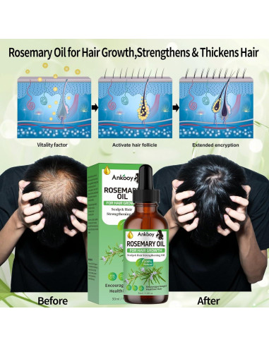 Aceite de Batana y Romero para Crecimiento del Cabello 230g