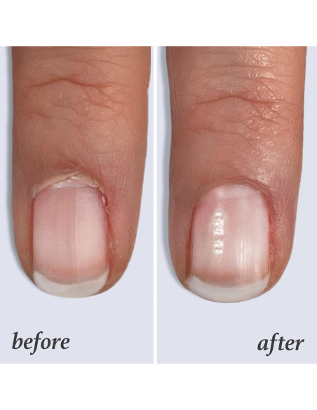 Aceite Esencial para Cutículas Julep 10.4 ml - Hidratante con Vitamina E