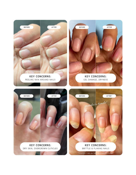 Aceite de Cutícula Diario Vacance 9mL Viaje Antiinflamatorio