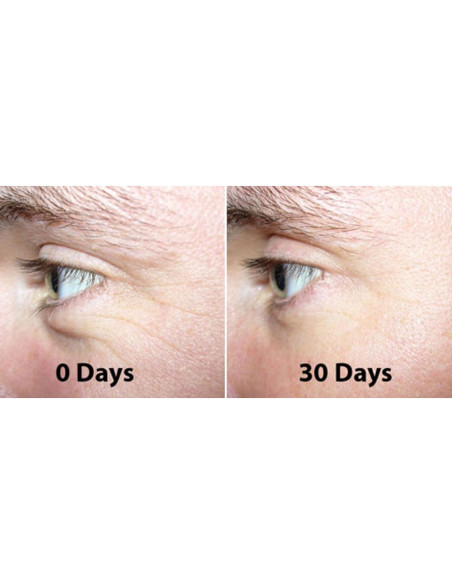 Suero Nocturno Antiarrugas 100% Ácido Hialurónico 113g