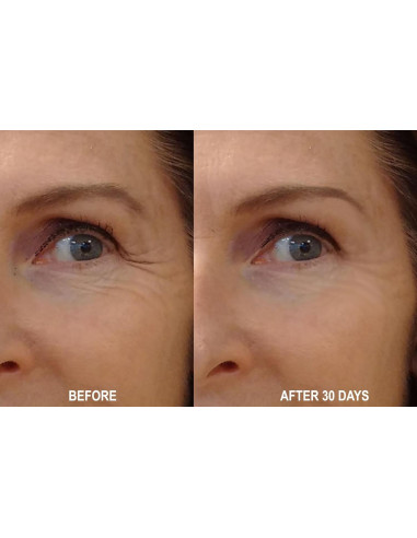 Suero Nocturno Antiarrugas 100% Ácido Hialurónico 113g