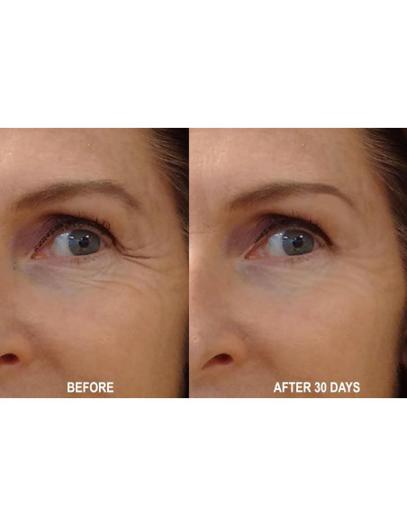 Suero Nocturno Antiarrugas 100% Ácido Hialurónico 113g