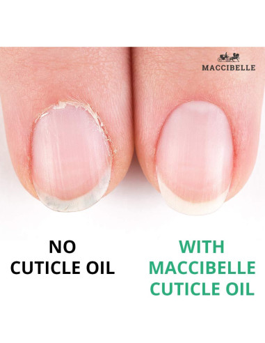 Aceite para Cutículas Maccibelle 15 ml - Aroma Limón