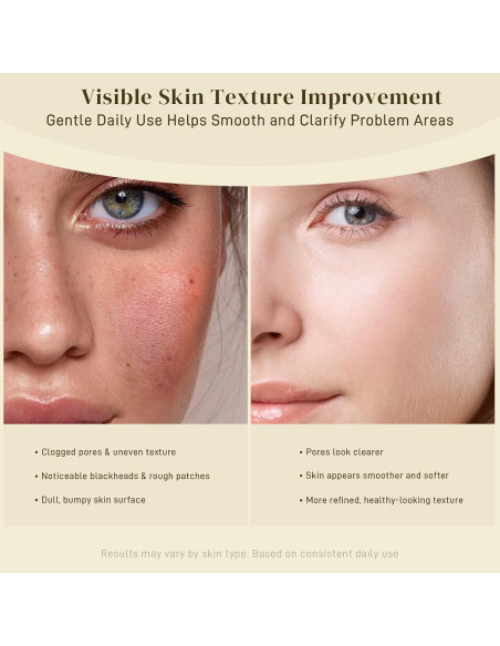 Almohadillas de Limpieza Facial AOPO con Ácido Kójico y Cúrcuma - 50 Pcs