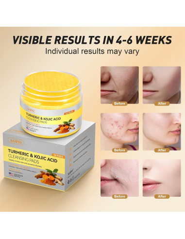 Almohadillas de Limpieza Facial AOPO con Ácido Kójico y Cúrcuma - 50 Pcs
