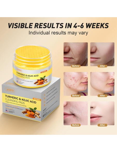 Almohadillas de Limpieza Facial AOPO con Ácido Kójico y Cúrcuma - 50 Pcs