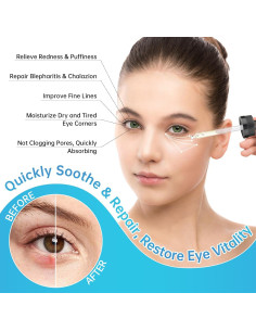 Suero para Ojos MIZEEYE 2 PCS - Tratamiento Chalazión y Blefaritis 2