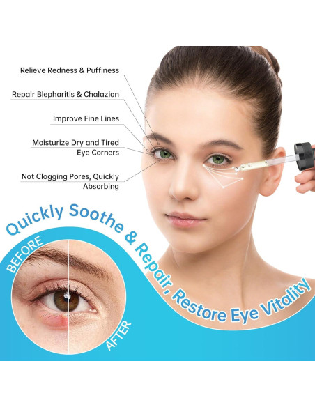 Suero para Ojos MIZEEYE 2 PCS - Tratamiento Chalazión y Blefaritis