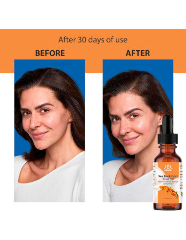 Aceite de Espino Marino Relaxcation 14.79 ml - Hidratante Natural