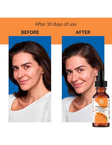 Aceite de Espino Marino Relaxcation 14.79 ml - Hidratante Natural