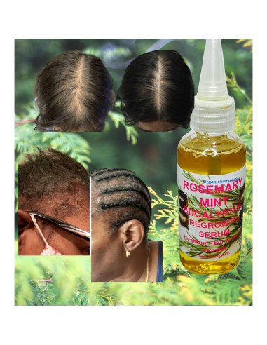 Aceite Nutritivo para Cabello Romero Menta Eucalipto 59 ml