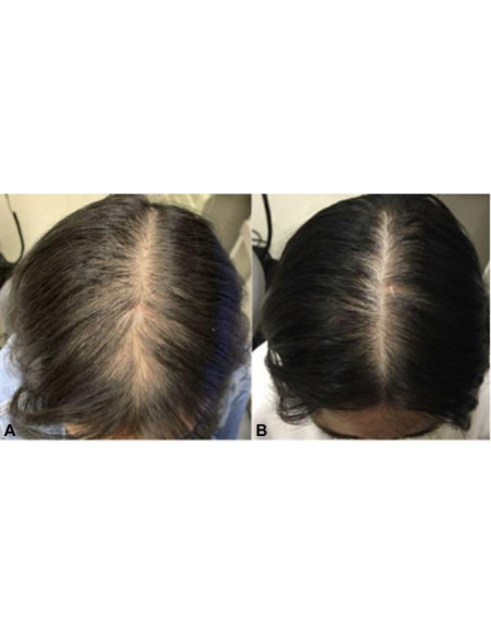 Aceite Nutritivo para Cabello Romero Menta Eucalipto 59 ml