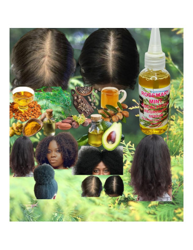 Aceite Nutritivo para Cabello Romero Menta Eucalipto 59 ml