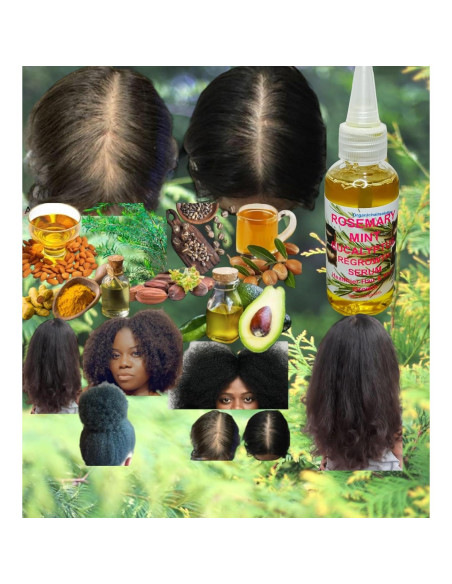 Aceite Nutritivo para Cabello Romero Menta Eucalipto 59 ml