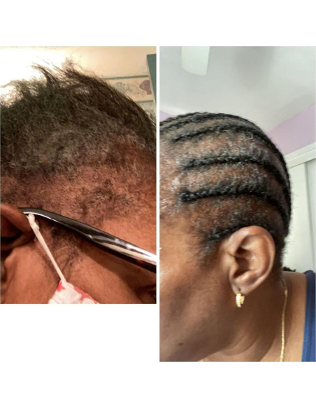 Aceite Nutritivo para Cabello Romero Menta Eucalipto 59 ml