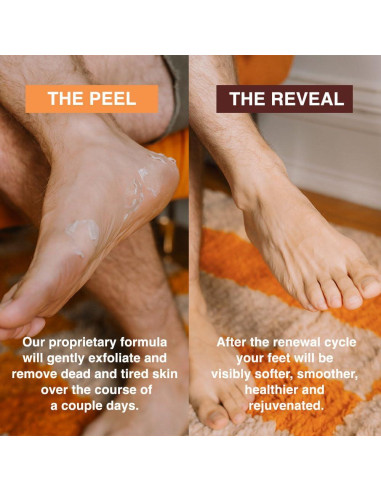 Mascarilla Exfoliante para Pies FEETS con Eucalipto y Lavanda - 2 Botines