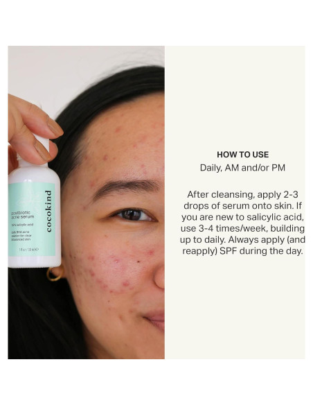 Suero Postbiótico Cocokind 1.5% Ácido Salicílico 92g