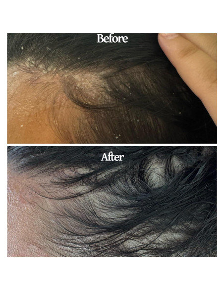 Set Aceite para Cuero Cabelludo y Cepillo Finalmente 368g Set Aceite para Cuero Cabelludo y Cepillo Finalmente 368g