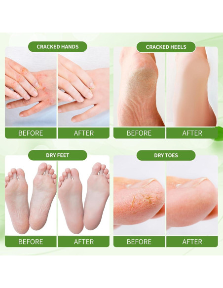 Removedor de Callos Loción Hidratante 250ml Jazmín Removedor de Callos Loción Hidratante 250ml Jazmín