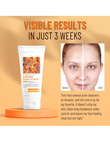 ABERA Limpiador Facial Suave 100ml con Curcumina y Niacinamida