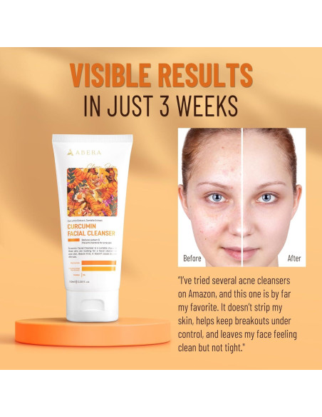ABERA Limpiador Facial Suave 100ml con Curcumina y Niacinamida