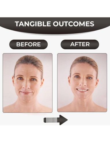 Cinta Facial Antienvejecimiento Wisper Tape - 2 Rollos 3m