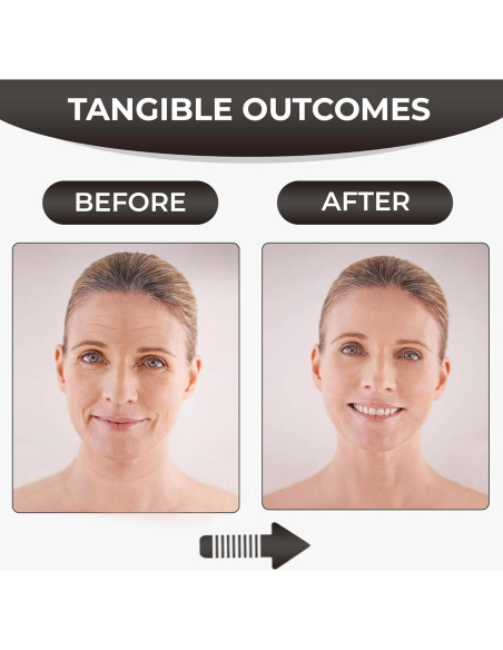 Cinta Facial Antienvejecimiento Wisper Tape - 2 Rollos 3m