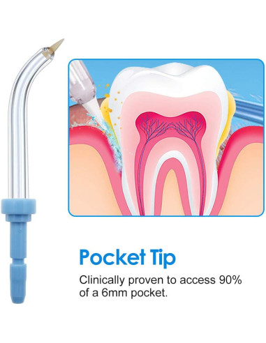 Consejos Periodontales RONSIT para Irrigadores Orales - Paquete de 4