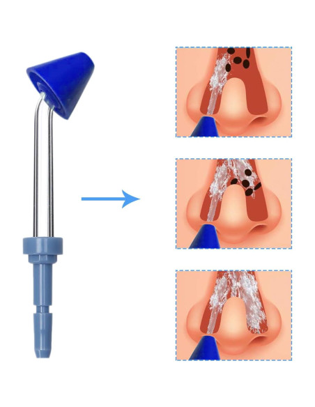 Puntas de Reemplazo para Irrigador Oral Waterpik - 6 Unidades