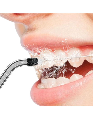 Consejos de Reemplazo Ortodónticos COSLUS F5020E - 4 Piezas