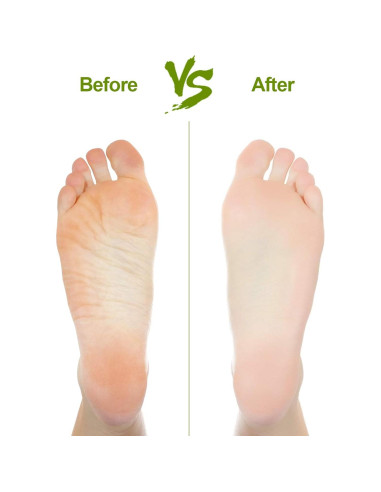 Piedra Pómez Natural Asqraqo 2 Pcs para Remover Callos