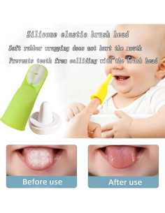 Cepillo de Dientes para Bebés FOREVIVE Verde con Estuche 2