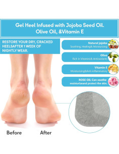 Calcetines Hidratantes de Gel Hoovcmg para Talones Agrietados 2